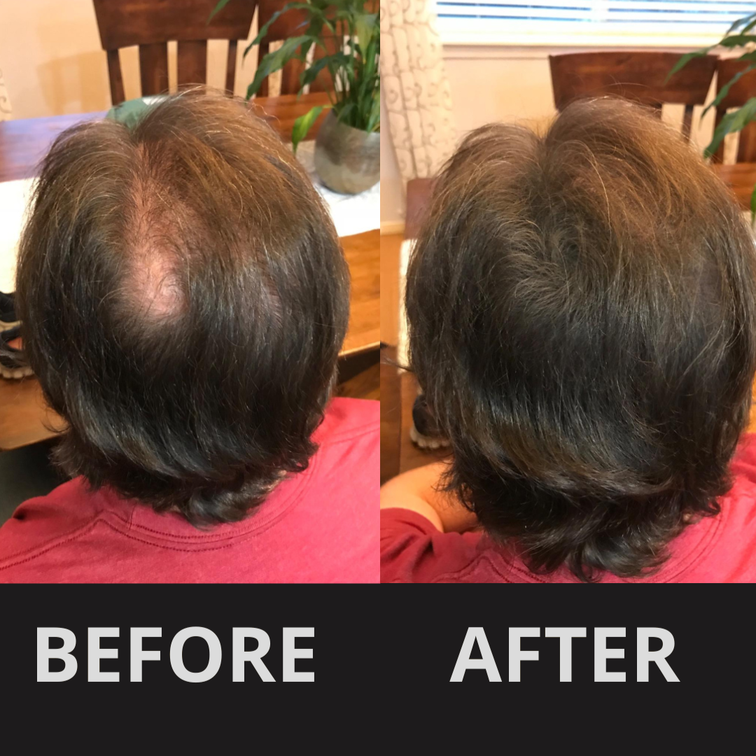 HairFill Hair Concealer™ – Black 50ml