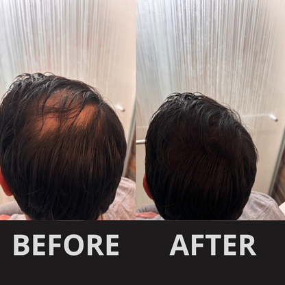 HairFill Hair Concealer™ – Black 50ml