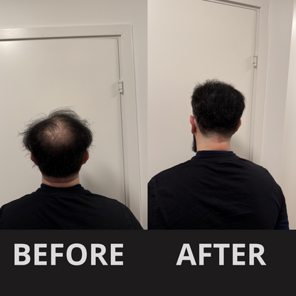 HairFill Hair Concealer™ – Black 50ml